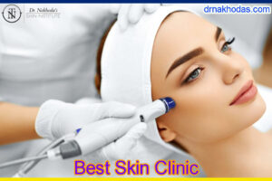 Original Picoway Laser Treatment For Skin Pore Reduction