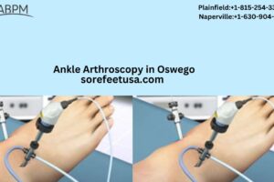 Busting Common Misinformation About Ankle Arthroscopy & Wart Treatment In Oswego, IL