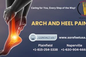 Conquering Arch and Heel Pain: A Comprehensive Guide to Relief