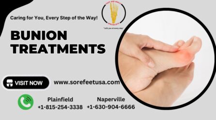 Comprehensive Guide to Bunion Treatments: Relief and Prevention