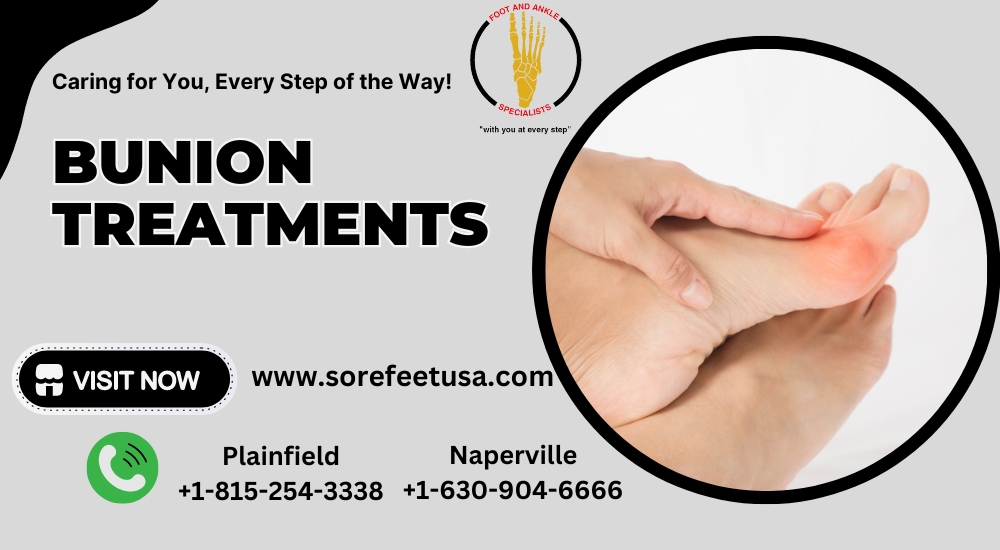 Comprehensive Guide to Bunion Treatments: Relief and Prevention